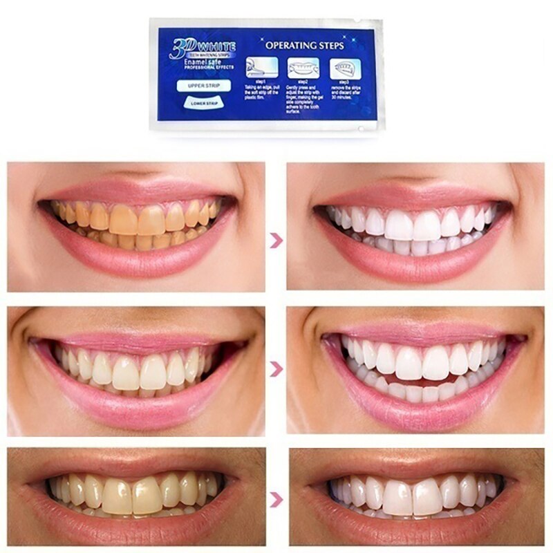 28Pcs/14Pair false Teeth Veneers Dentist 3D White Gel Teeth Whitening Strips Tooth Dental kit Oral Hygiene Care Strip sets